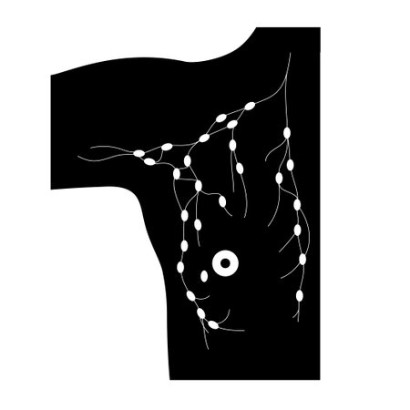 Breast disease conceptのイラスト素材