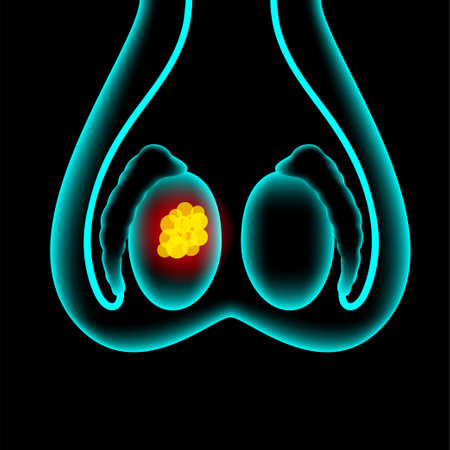Prostate cancer conceptのイラスト素材