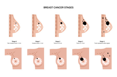 Breast disease conceptのイラスト素材