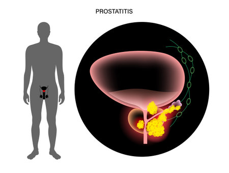 Prostate cancer conceptのイラスト素材