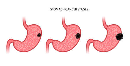Stomach logo conceptのイラスト素材