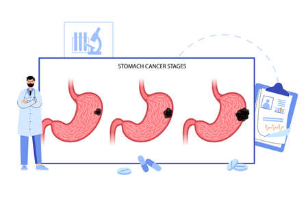 Stomach  conceptのイラスト素材