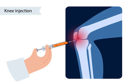 Knee Injection conceptのイラスト素材