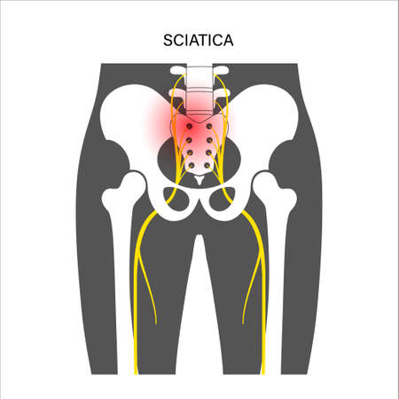 Muscular pelvis conceptのイラスト素材