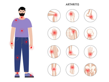 Arthritis in man silhouetteのイラスト素材