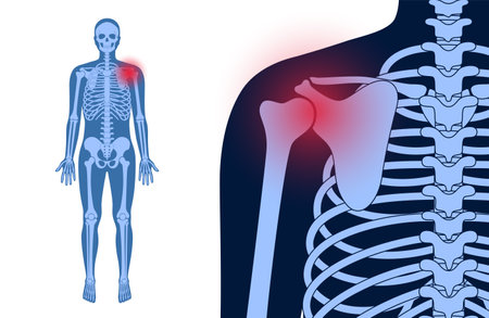 Shoulder pain conceptのイラスト素材