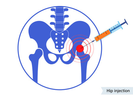 Hip joint injectionのイラスト素材