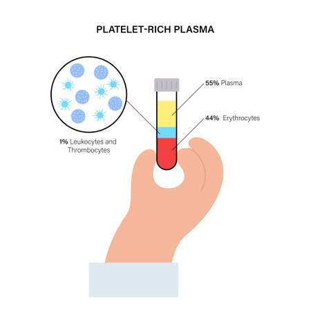 Platelet rich plasma conceptのイラスト素材