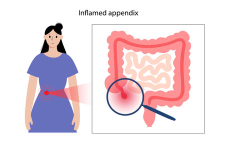 Appendix pain conceptのイラスト素材