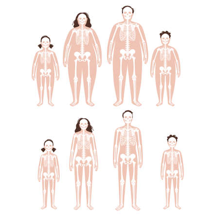 Obese skeleton anatomyのイラスト素材