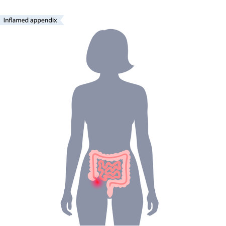 Appendix pain conceptのイラスト素材