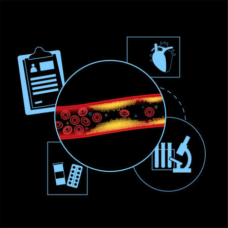Cholesterol blood arteryのイラスト素材