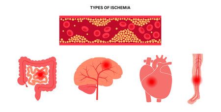 Types of ishemiaのイラスト素材
