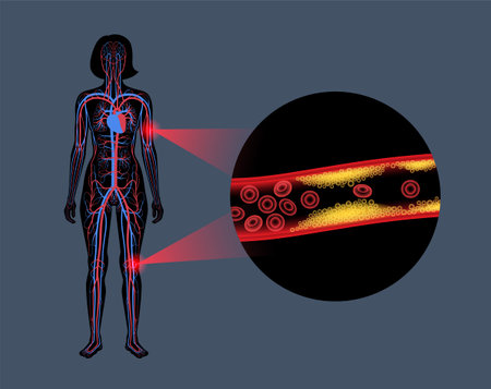 Peripheral artery diseaseのイラスト素材