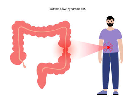 Irritable bowel syndromeのイラスト素材