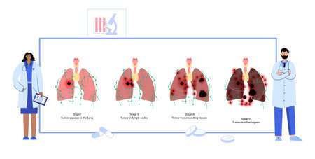 Lungs cancer diseaseのイラスト素材