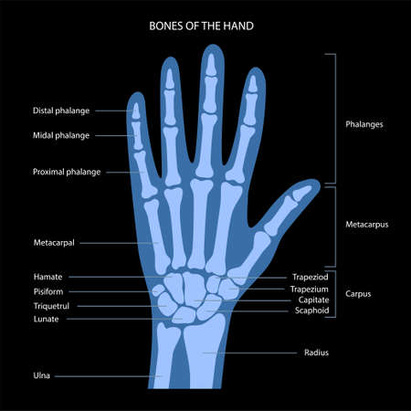 Hand bone anatomyのイラスト素材