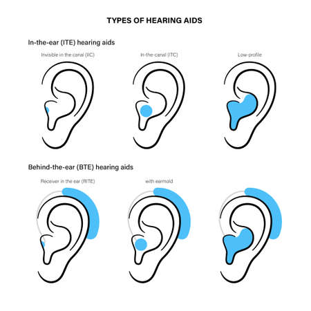 Hearing aids typesのイラスト素材
