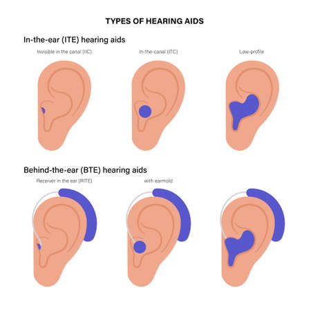 Hearing aids typesのイラスト素材