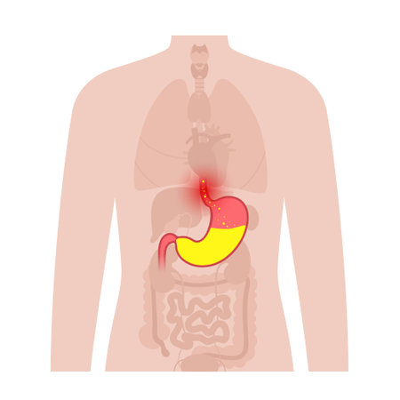 Gastroesophageal reflux diseaseのイラスト素材