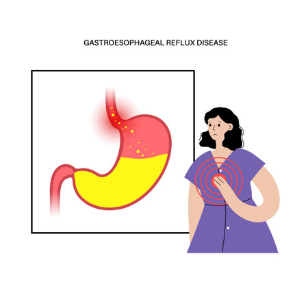 Gastroesophageal reflux diseaseのイラスト素材