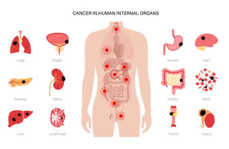 Cancer icons setのイラスト素材