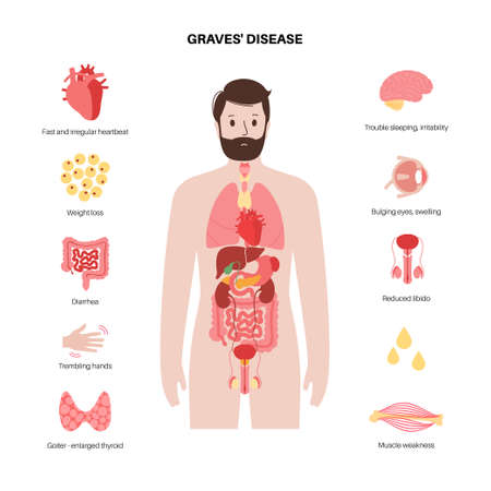 Graves desease symptomsのイラスト素材