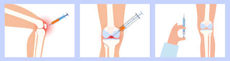 Knee Injection procedureのイラスト素材