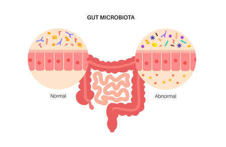 Human gut microbiotaのイラスト素材