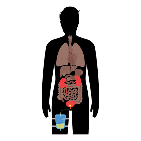 Urinary drainage bagのイラスト素材