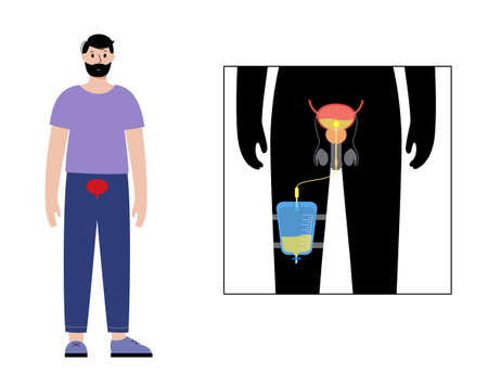 Urinary drainage bagのイラスト素材