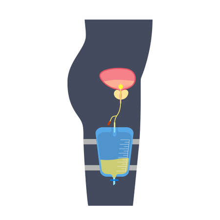 Urinary drainage bagのイラスト素材