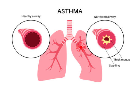 Asthma lung diseaseのイラスト素材