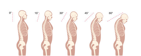 Neck vertebrae deformity