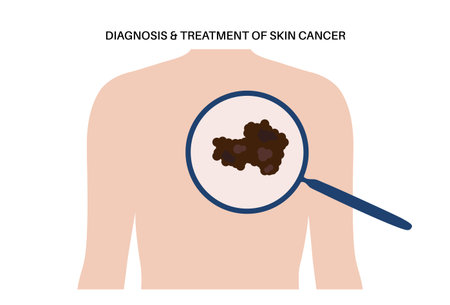Skin cancer diagnosisのイラスト素材