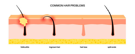 Common hair problemsのイラスト素材