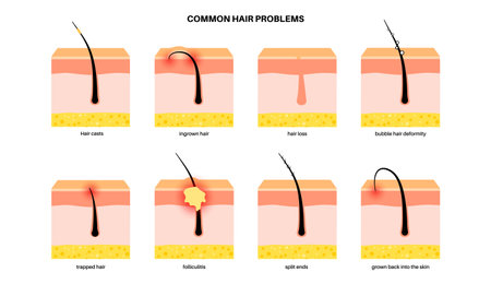 Common hair problemsのイラスト素材