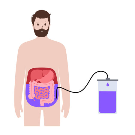 Abdominal paracentesis posterのイラスト素材