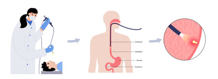 Gastroscopy endoscopy procedureのイラスト素材