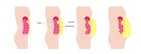 Visceral fat diagramのイラスト素材