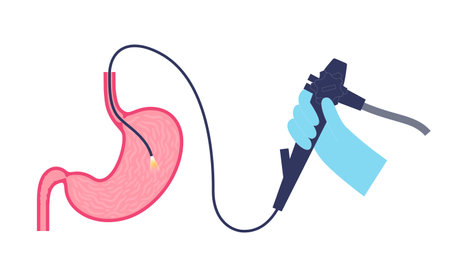 Gastroscopy endoscopy procedureのイラスト素材