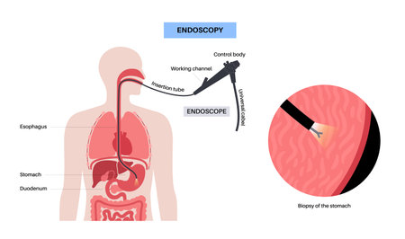 Gastroscopy endoscopy procedure