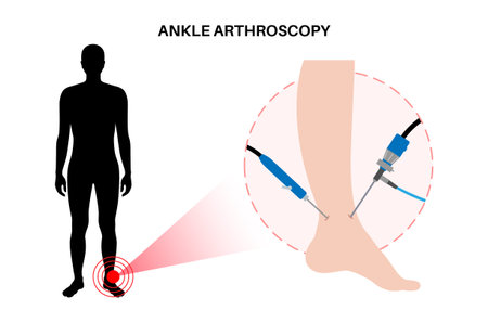 Ankle arthroscopy posterのイラスト素材