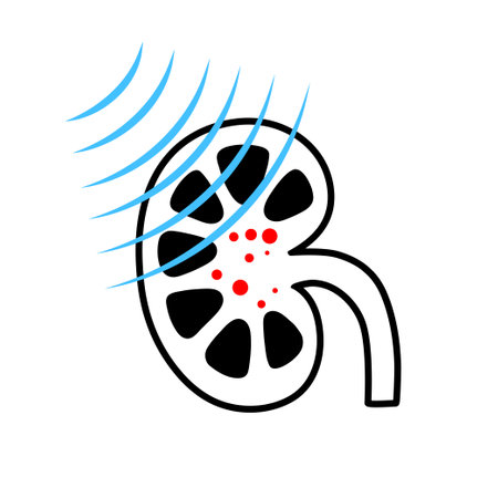 Lithotripsy procedure conceptのイラスト素材