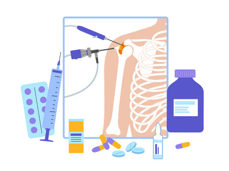Shoulder arthroscopy posterのイラスト素材