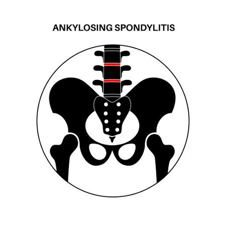 Ankylosing spondylitis disease