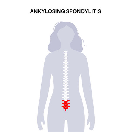 Ankylosing spondylitis diseaseのイラスト素材