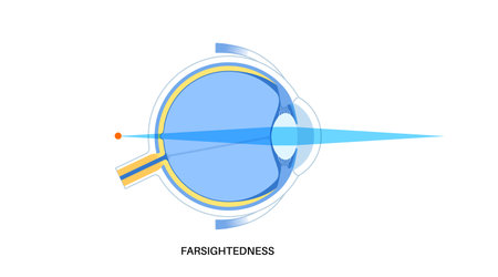 Farsightedness eye diseaseのイラスト素材