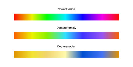 Deuteranomaly and deuteranopiaのイラスト素材