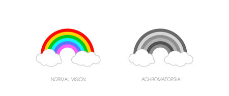 Achromatopsia vision deficiencyのイラスト素材